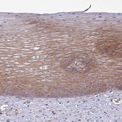 SH2D1B Antibody, Novus Biologicals 25 &mu;L, Unlabeled:Antibodies, Polyclonal